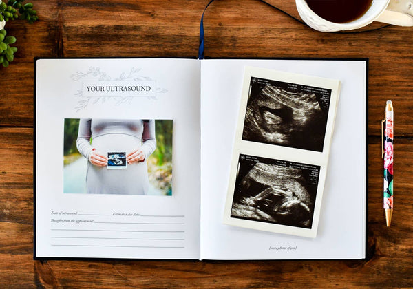 Dear Baby: Pregnancy Prayer Journal + Memory Book for Moms | Ivory