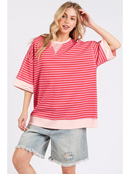 loving detail striped oversized top | pink combo