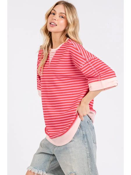 loving detail striped oversized top | pink combo